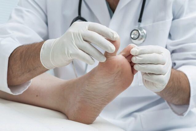 diagnóstico de hongos en los pies por un médico