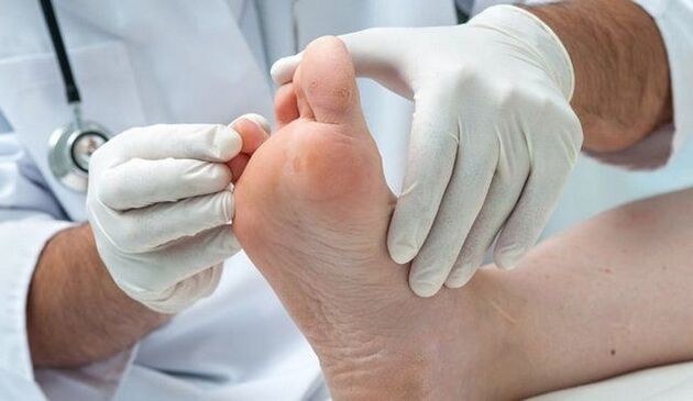 tratamiento y diagnóstico de hongos por un médico