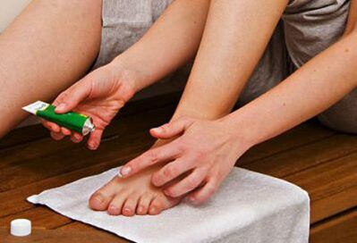 aplicar ungüento para tratar hongos en las uñas de los pies