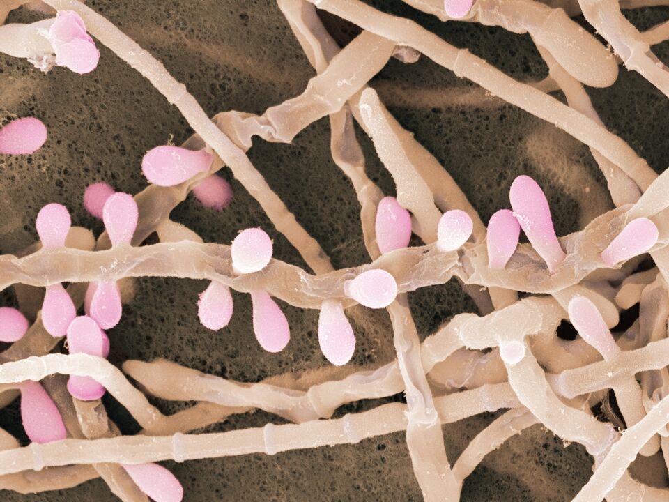 Trichophyton rubrum es un tipo de hongo que afecta la piel de los pies.